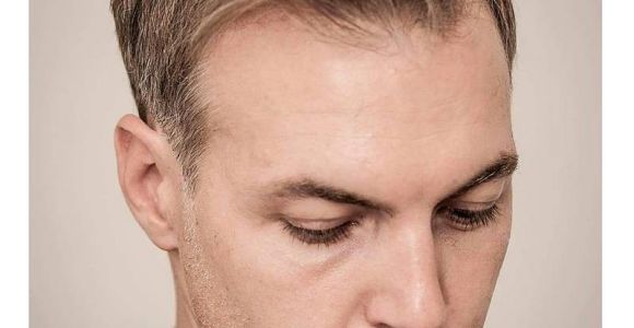 Balding Men S Hairstyles 10 Best Hairstyles for Balding Men